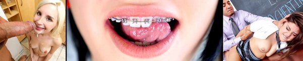 Brace Faced